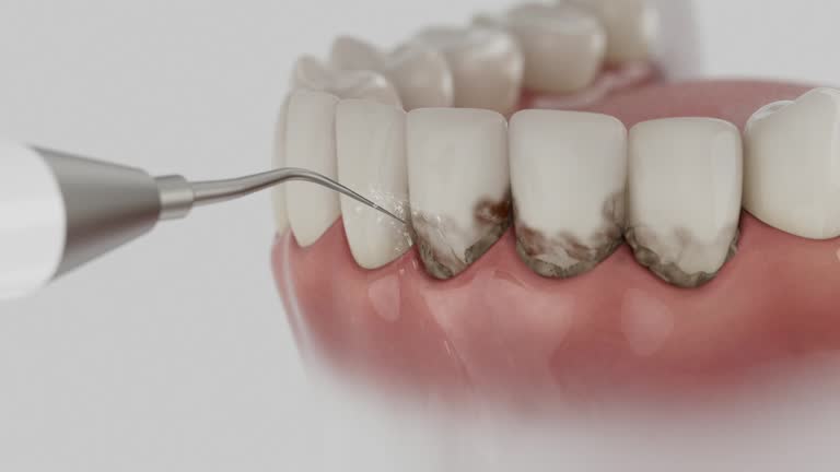 Reliable Teeth Cleaning And Checkup contractor in Franklin County County, KS by Dentist Open Now